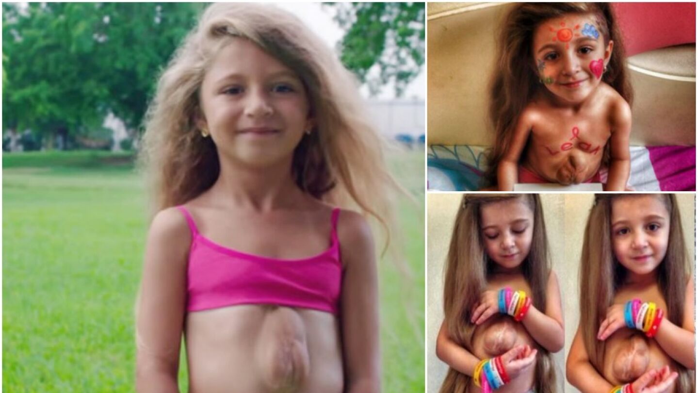 El cambio de la peque&ntilde;a en dos a&ntilde;os 