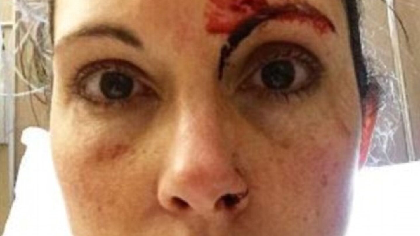 Kelly Herron en la foto publicada despu&eacute;s del intento de violaci&oacute;n