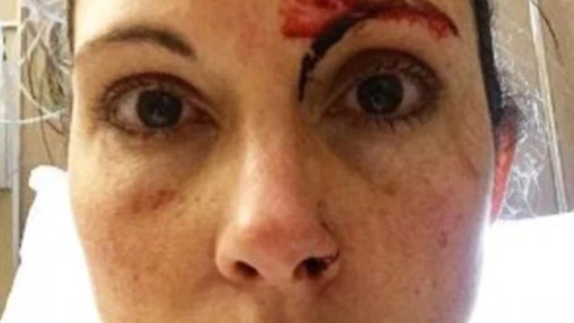 Kelly Herron en la foto publicada después del intento de violación Kelly Herron en la foto publicada después del intento de violación