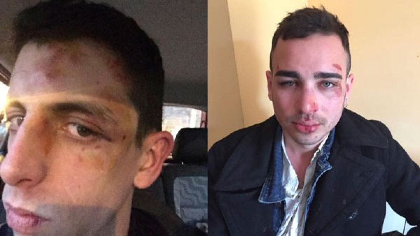 Uno de los j&oacute;venes agredidos ha contado en redes c&oacute;mo sucedi&oacute; todo