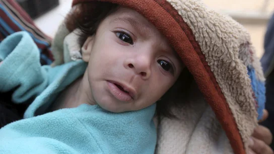 Las sanciones de Europa y EEUU arruinan indirectamente el tratamiento contra el cáncer para cientos de niños de Siria Las sanciones de Europa y EEUU arruinan indirectamente el tratamiento contra el cáncer para cientos de niños de Siria