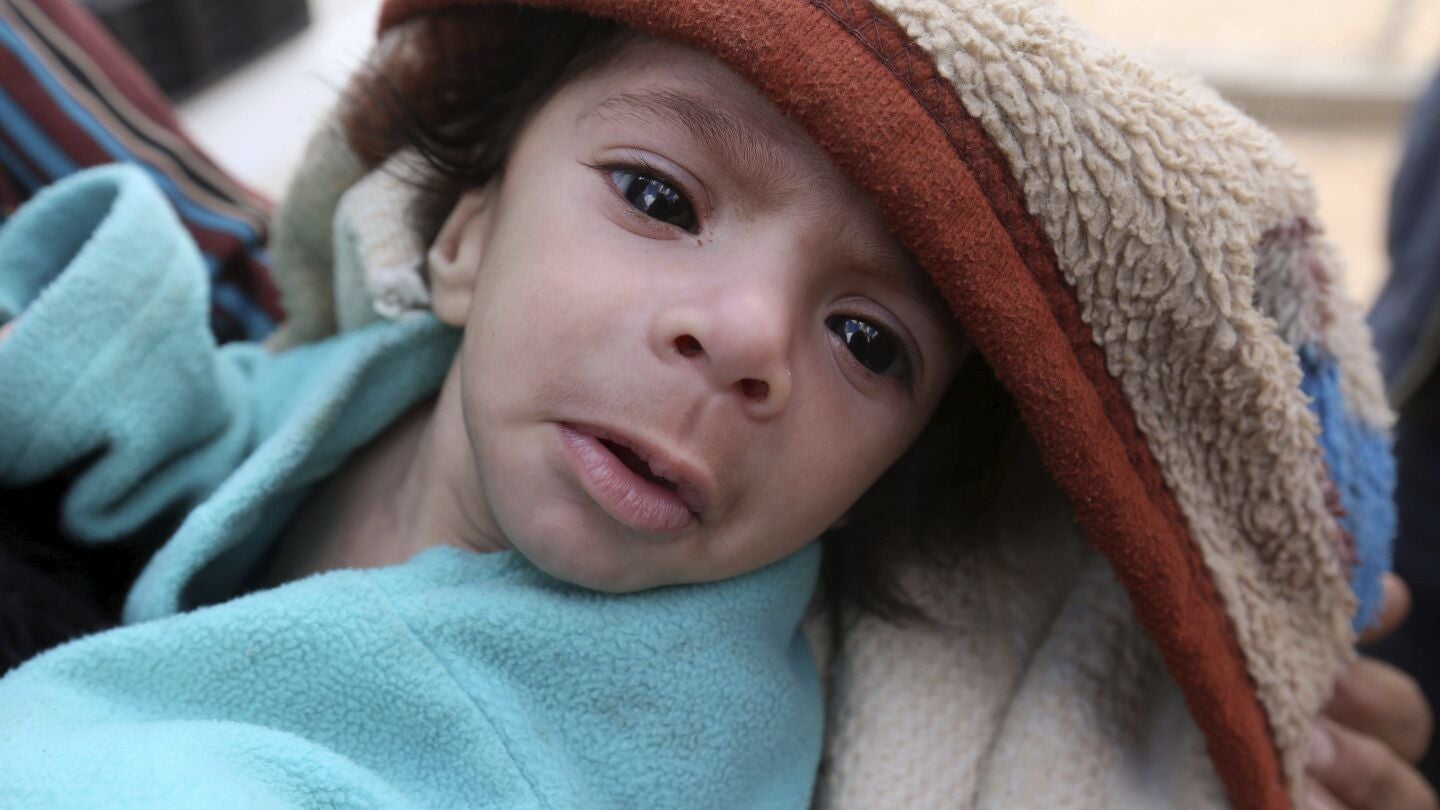 Las sanciones de Europa y EEUU arruinan indirectamente el tratamiento contra el c&aacute;ncer para cientos de ni&ntilde;os de Siria