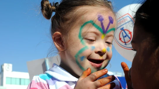 Niña con Síndrome de Down Niña con Síndrome de Down