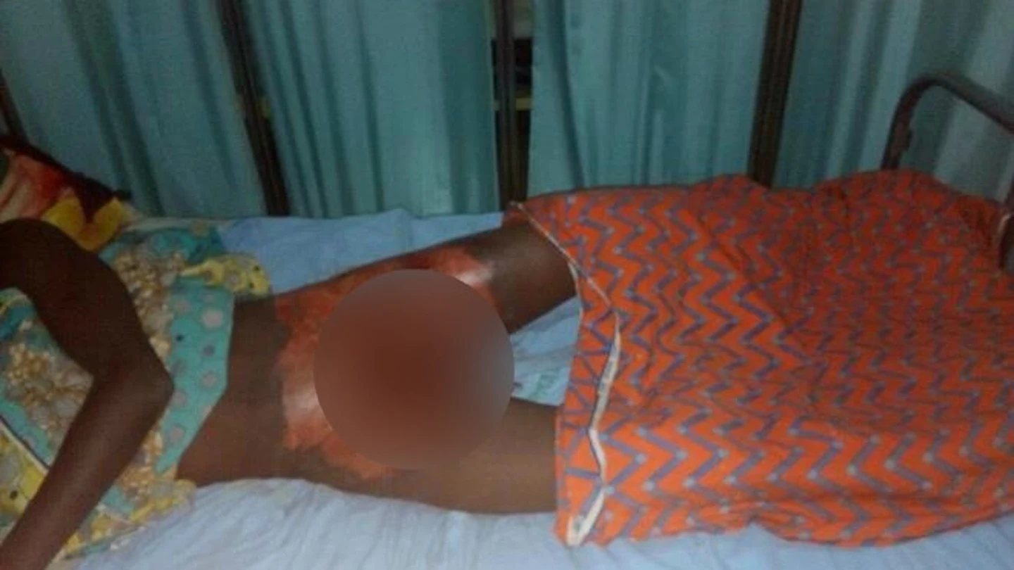 El presunto violador en el hospital de Sokoto, Nijeria, tras ser atendido El presunto violador en el hospital de Sokoto, Nijeria, tras ser atendido
