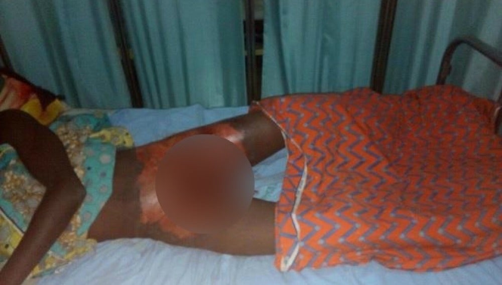 El presunto violador en el hospital de Sokoto, Nijeria, tras ser atendido
