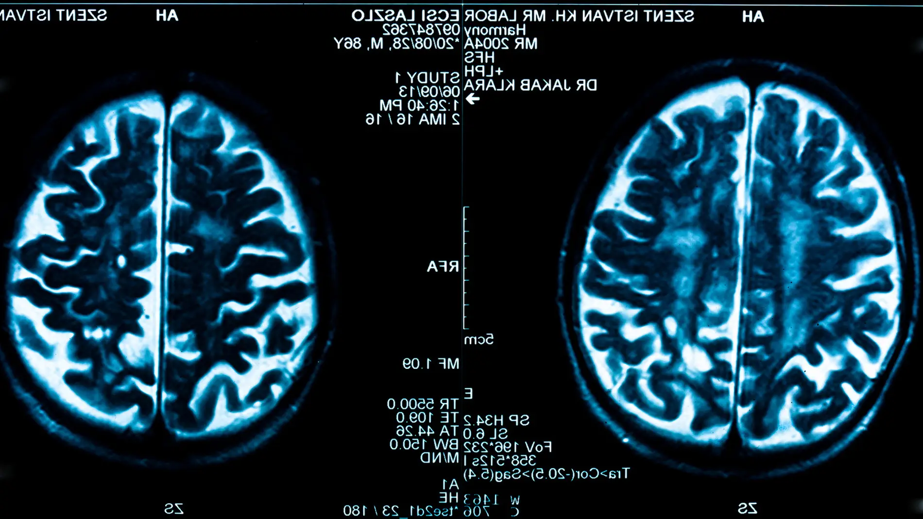 Contenidos virtuales para la rehabilitacion de pacientes con dano cerebral