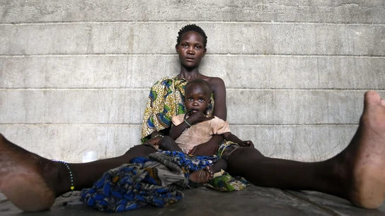 Una niña de la etnia Turkana con problemas de malnutrición en brazos de su madre (Archivo) Una niña de la etnia Turkana con problemas de malnutrición en brazos de su madre (Archivo)