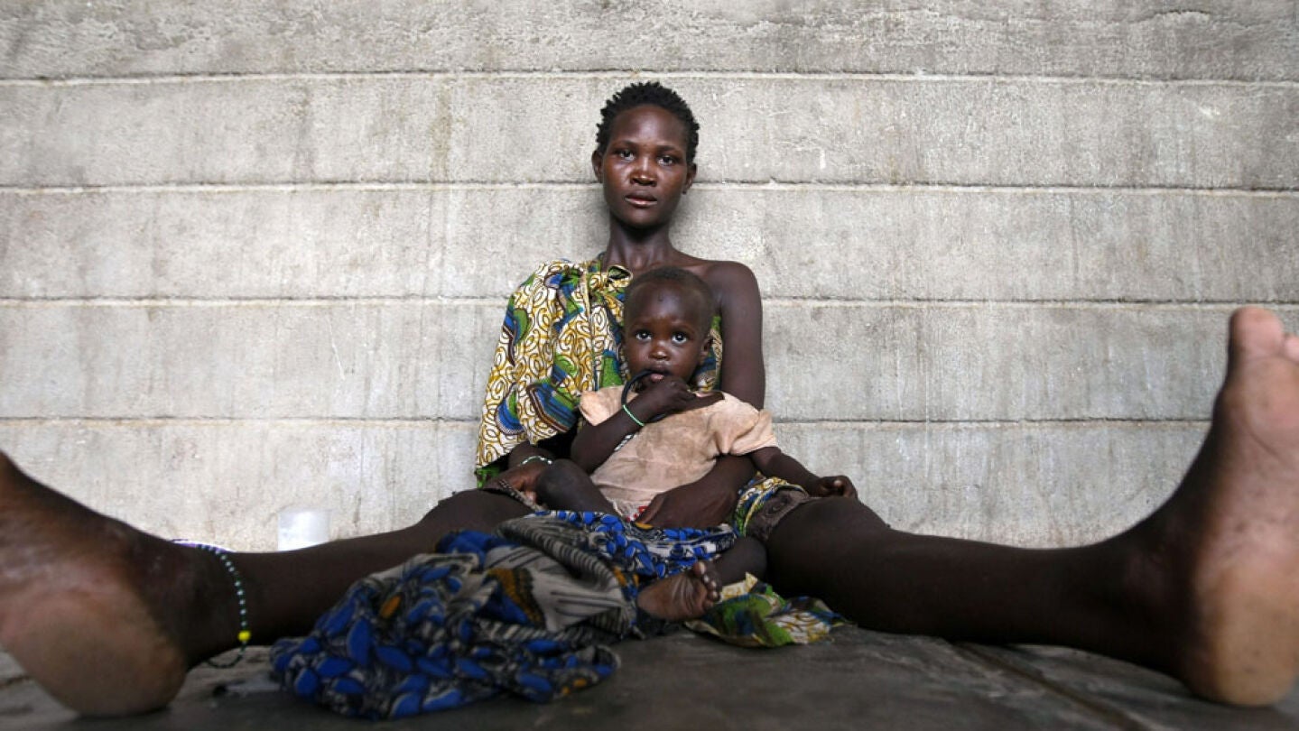 Una ni&ntilde;a de la etnia Turkana con problemas de malnutrici&oacute;n en brazos de su madre (Archivo)
