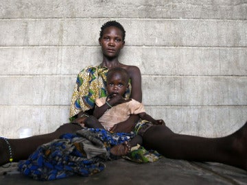 Una niña de la etnia Turkana con problemas de malnutrición en brazos de su madre (Archivo) Una niña de la etnia Turkana con problemas de malnutrición en brazos de su madre (Archivo)