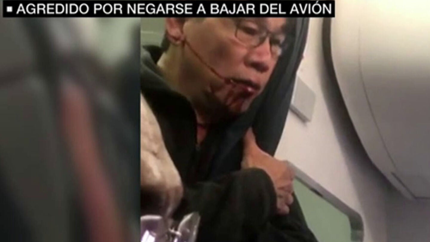 Pasajero agredido 