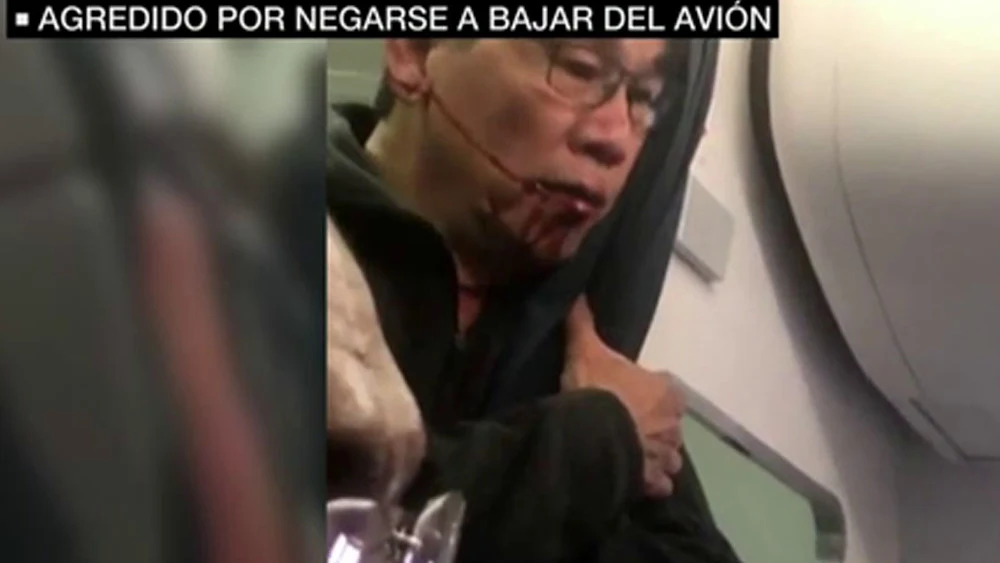Pasajero agredido Pasajero agredido