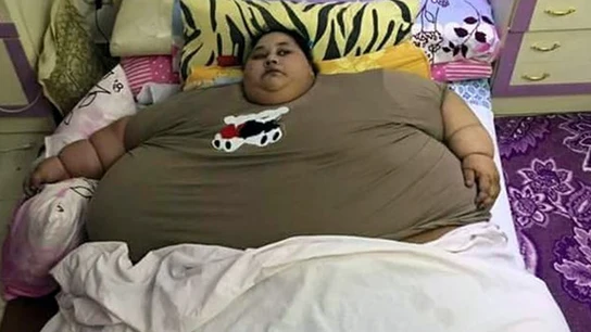 Eman Ahmed, la mujer más obesa del mundo Eman Ahmed, la mujer más obesa del mundo