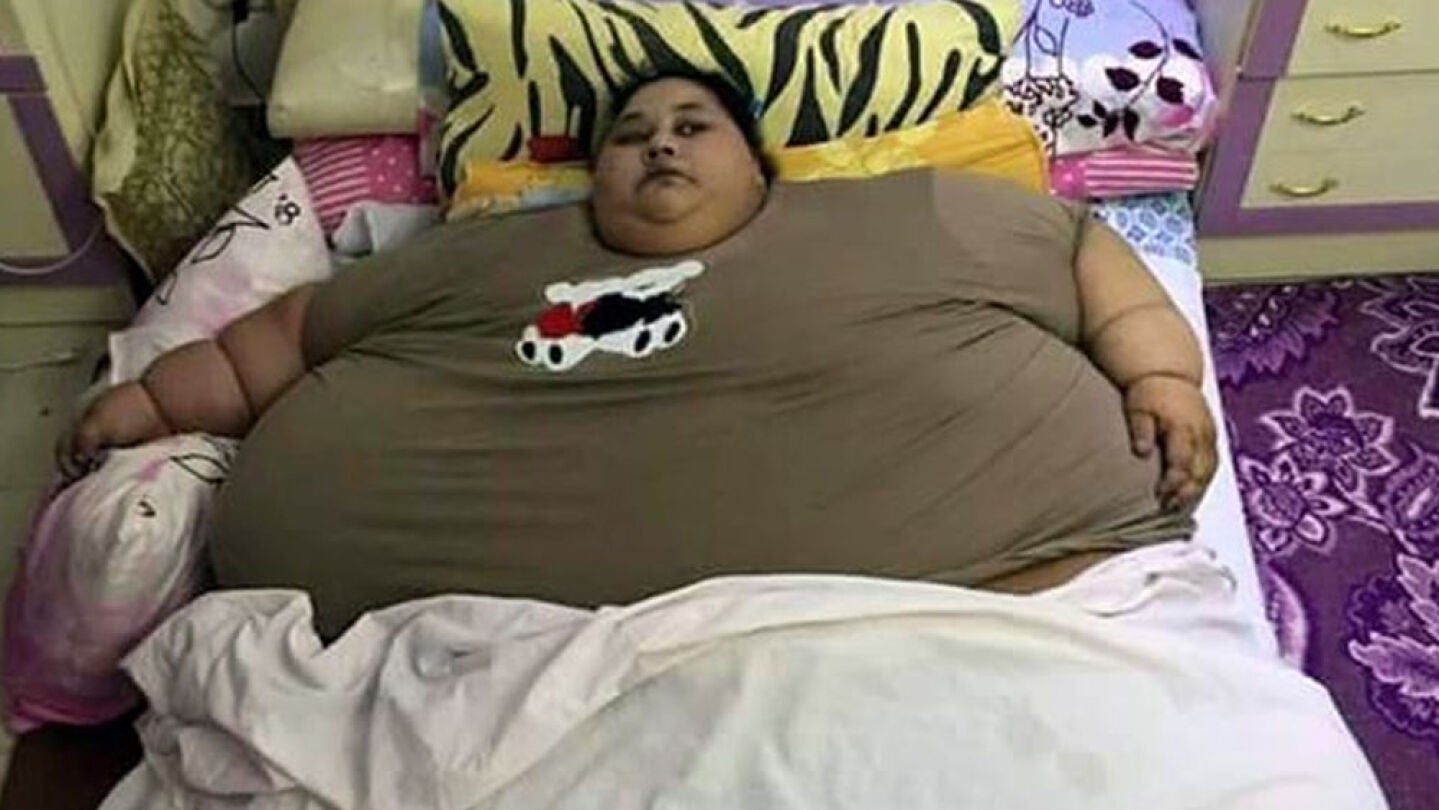 Eman Ahmed, la mujer m&aacute;s obesa del mundo
