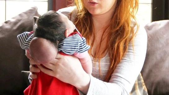 Rosa, el bebé que nació con el cerebro fuera del cráneo Rosa, el bebé que nació con el cerebro fuera del cráneo