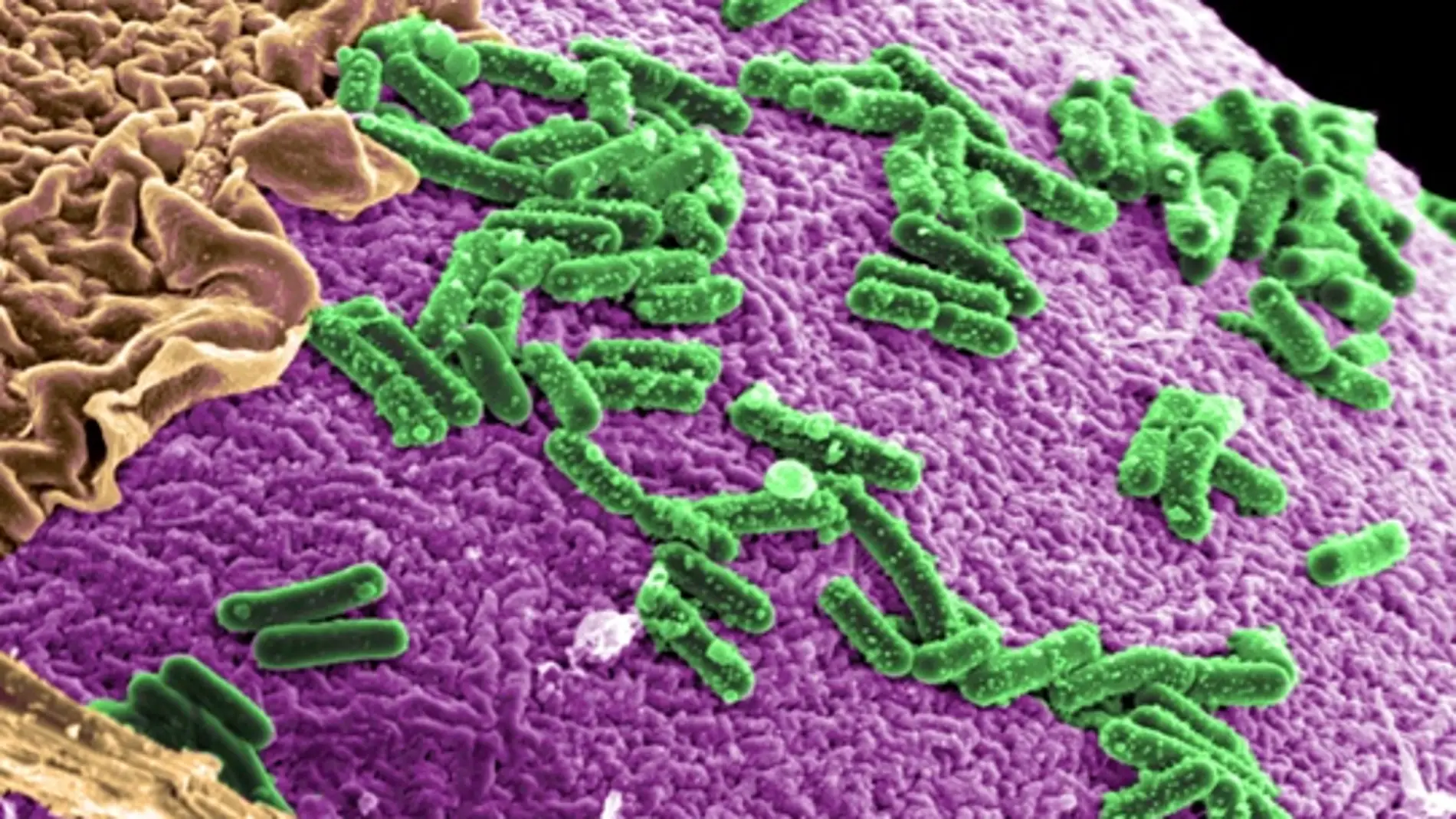 Improving Human Intestinal Gut - Pacific Northwestern National Laboratory