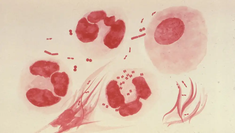 Ilustración de enterobacterias productoras de carbapenemasas