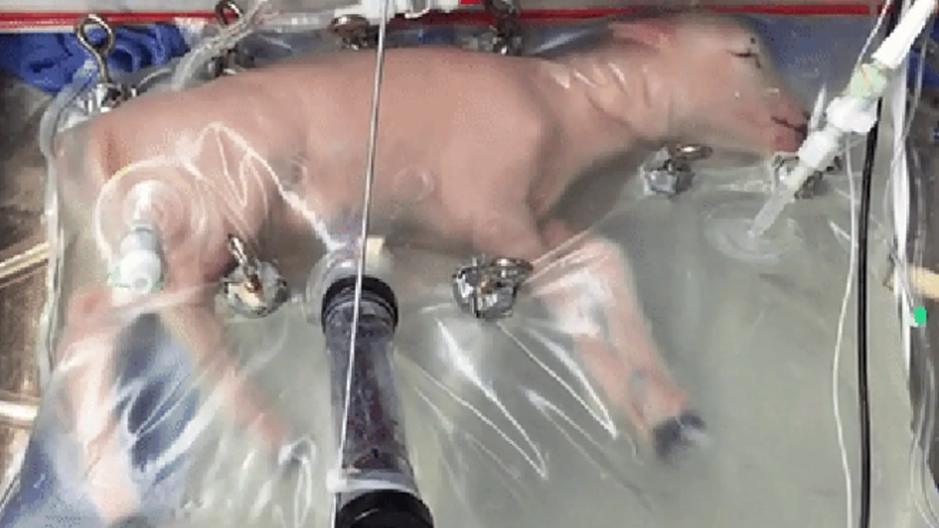 Un utero artificial permitira reducir la mortalidad en bebes muy prematuros