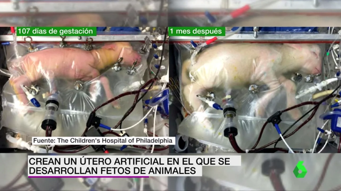 Frame 10.166624 de: Crean un útero artificial capaz de mantener con vida a fetos animales extremadamente prematuros Frame 10.166624 de: Crean un útero artificial capaz de mantener con vida a fetos animales extremadamente prematuros