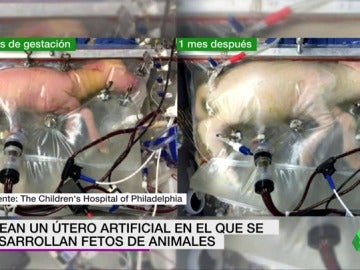Frame 10.166624 de: Crean un útero artificial capaz de mantener con vida a fetos animales extremadamente prematuros Frame 10.166624 de: Crean un útero artificial capaz de mantener con vida a fetos animales extremadamente prematuros