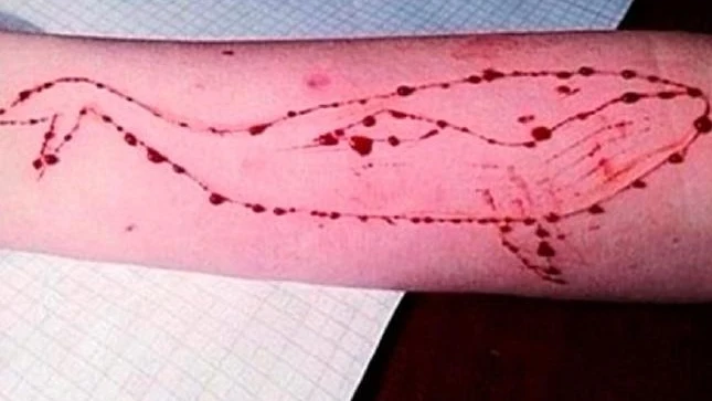 Brazo de un adolescente con lesiones dibujando una ballena