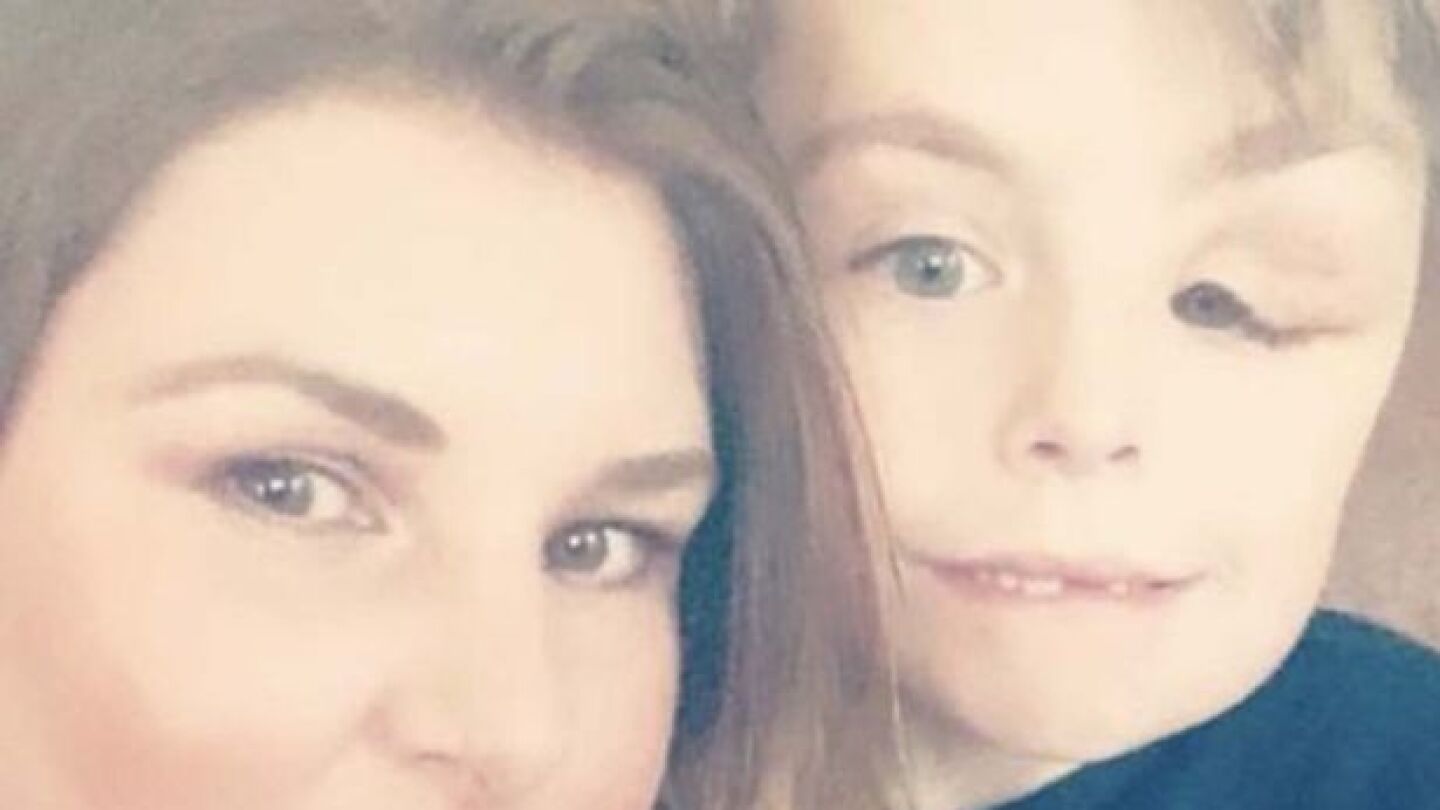 Koren Jeffcoate, un ni&ntilde;o con 'enfermedad del hombre elefante' y su madre