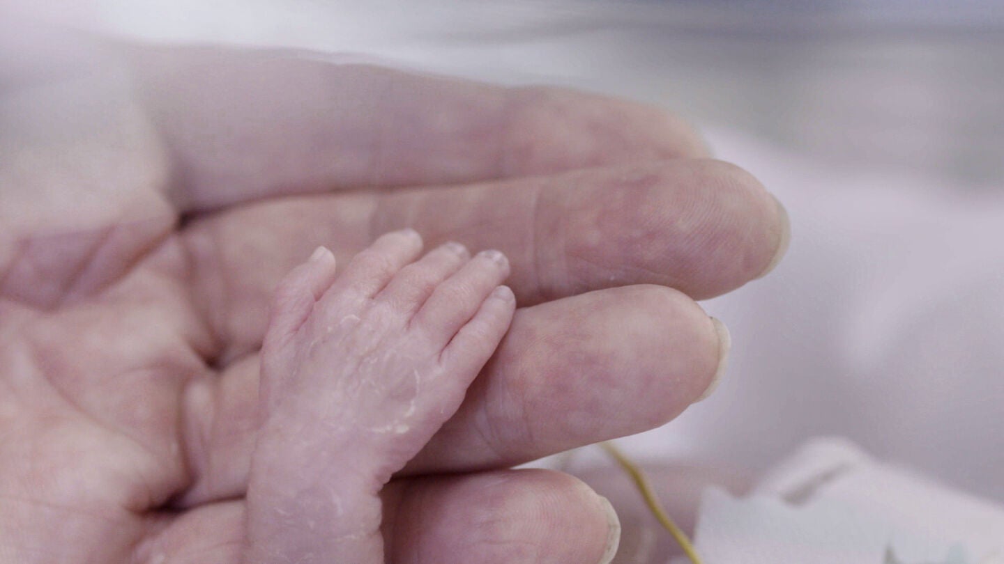 Un beb&eacute; prematuro