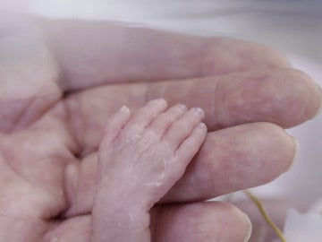 Un bebé prematuro Un bebé prematuro
