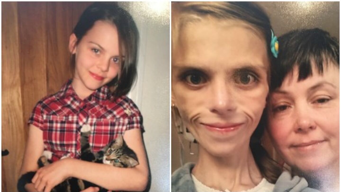 Pippa, la adolescente con anorexia que acab&oacute; suicid&aacute;ndose