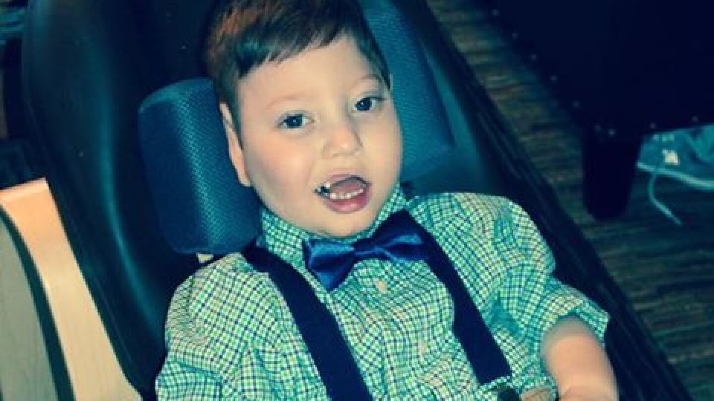 Malachi, el peque&ntilde;o de cuatro a&ntilde;os con discapacidad 