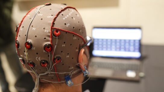 Estimulaci&oacute;n cerebral con electrodos