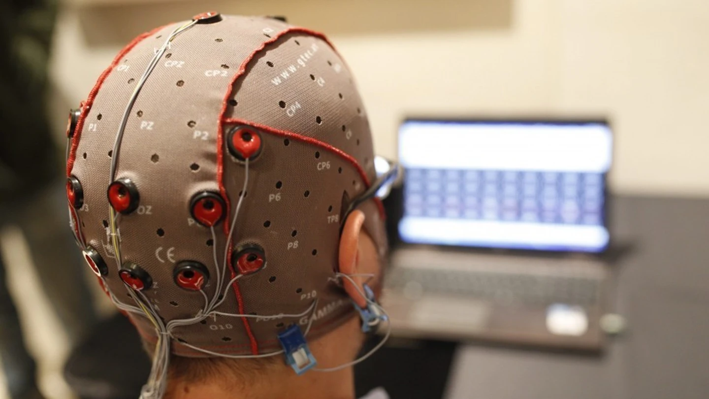 Estimulación cerebral con electrodos Estimulación cerebral con electrodos