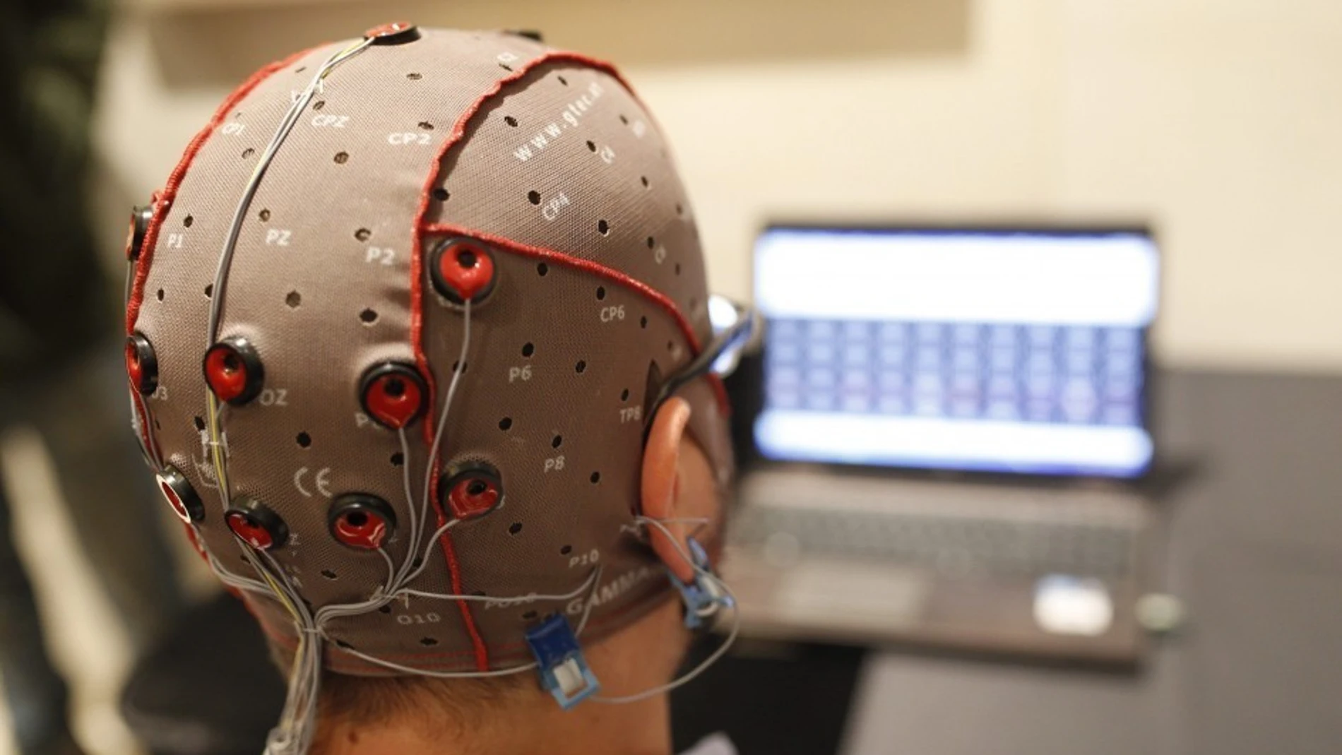 Estimulación cerebral con electrodos