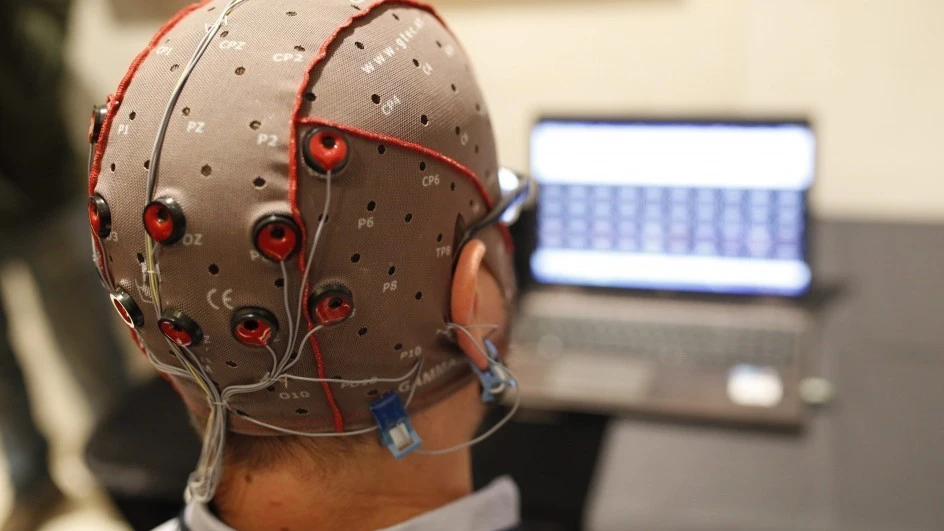 Estimulación cerebral con electrodos Estimulación cerebral con electrodos