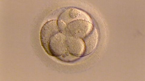 Existen varias razones por las que una mujer decide congelar sus óvulos