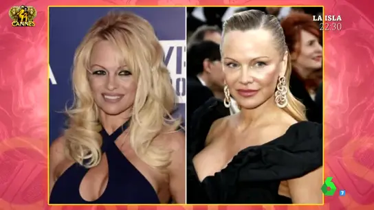 El cambio de rostro de Pamela Anderson El cambio de rostro de Pamela Anderson