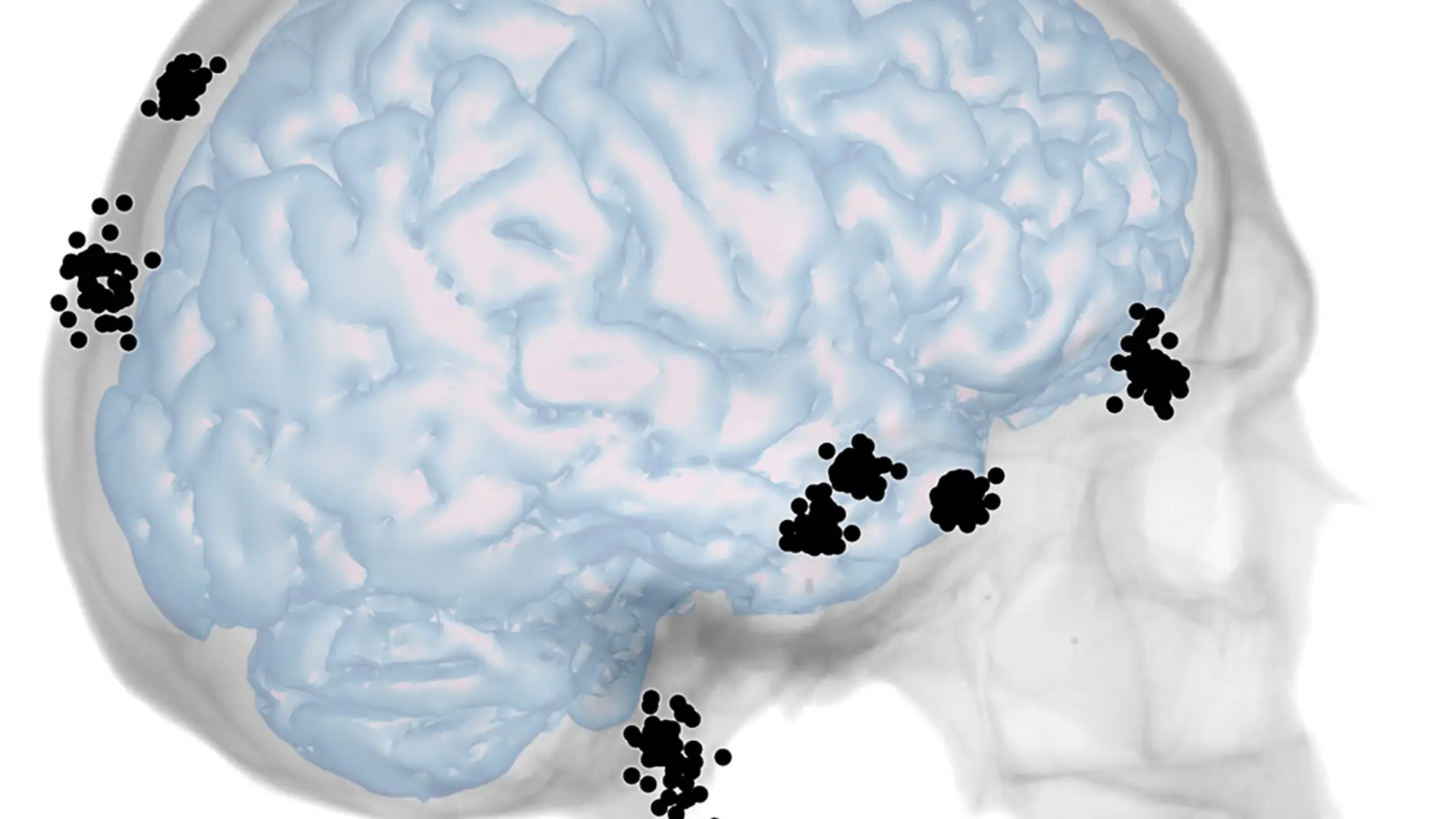 Un estudio da pistas sobre la integracion entre craneo y cerebro
