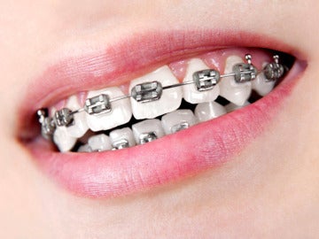 brackets brackets