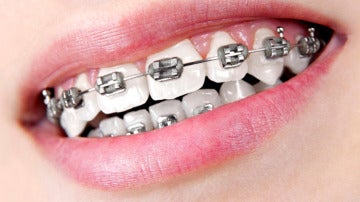 brackets brackets
