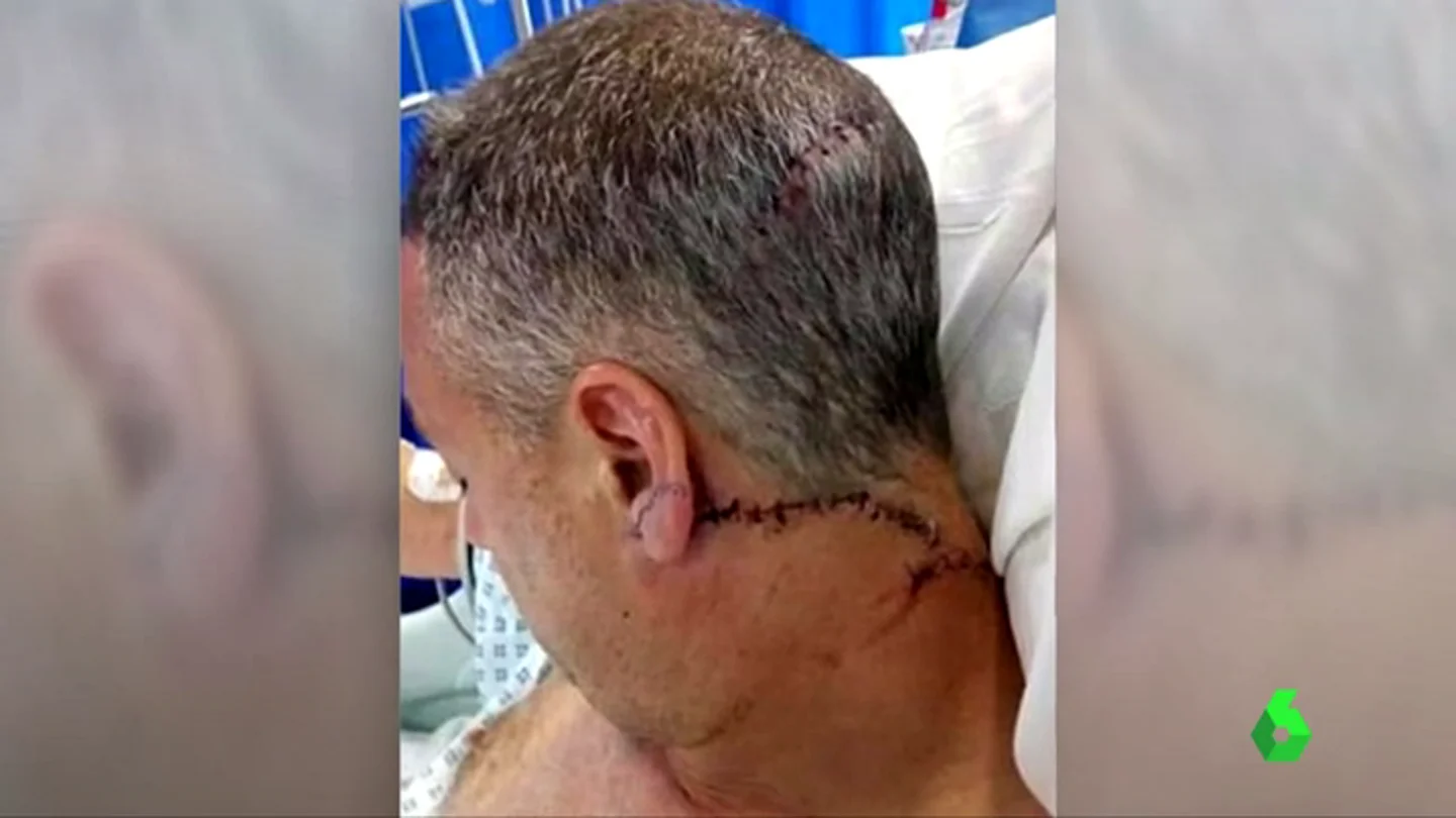 Roy Larner, superviviente del atentado en Londres Roy Larner, superviviente del atentado en Londres