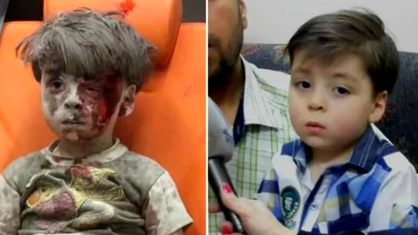 Omran, antes y después Omran, antes y después
