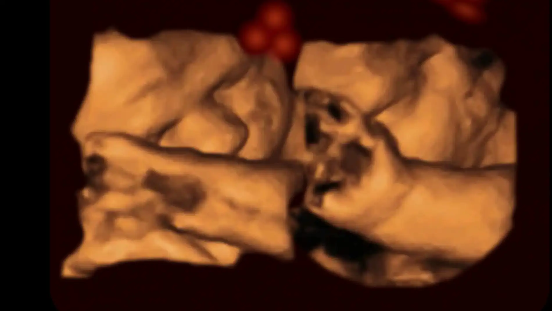 Fetos en desarrollo reaccionan al ver formas de caras dentro del utero