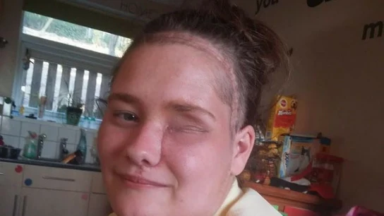 Ceri Jones tras la larga operación Ceri Jones tras la larga operación