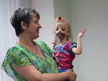 Darina, la niña que sufre una extraña deformación Darina, la niña que sufre una extraña deformación