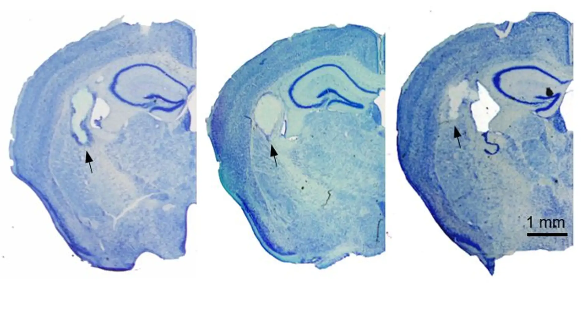 La fibroina de seda demuestra su eficacia en implantes cerebrales