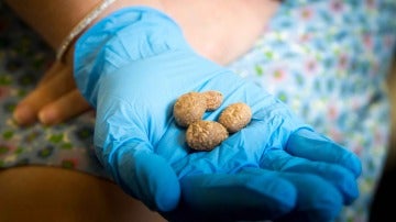 Hallan patatas de más de 10.900 años
