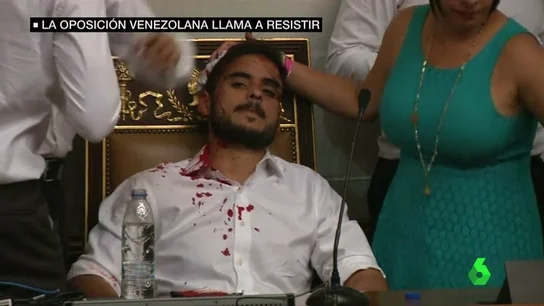 Diputado venezolano ensangrentado Diputado venezolano ensangrentado