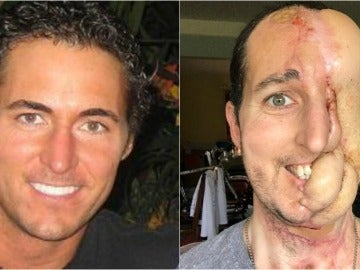 Tim McGrath antes de sufrir el cáncer y tras la última operación Tim McGrath antes de sufrir el cáncer y tras la última operación