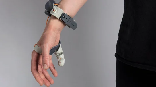 Tercer dedo gordo robótico. Tercer dedo gordo robótico.