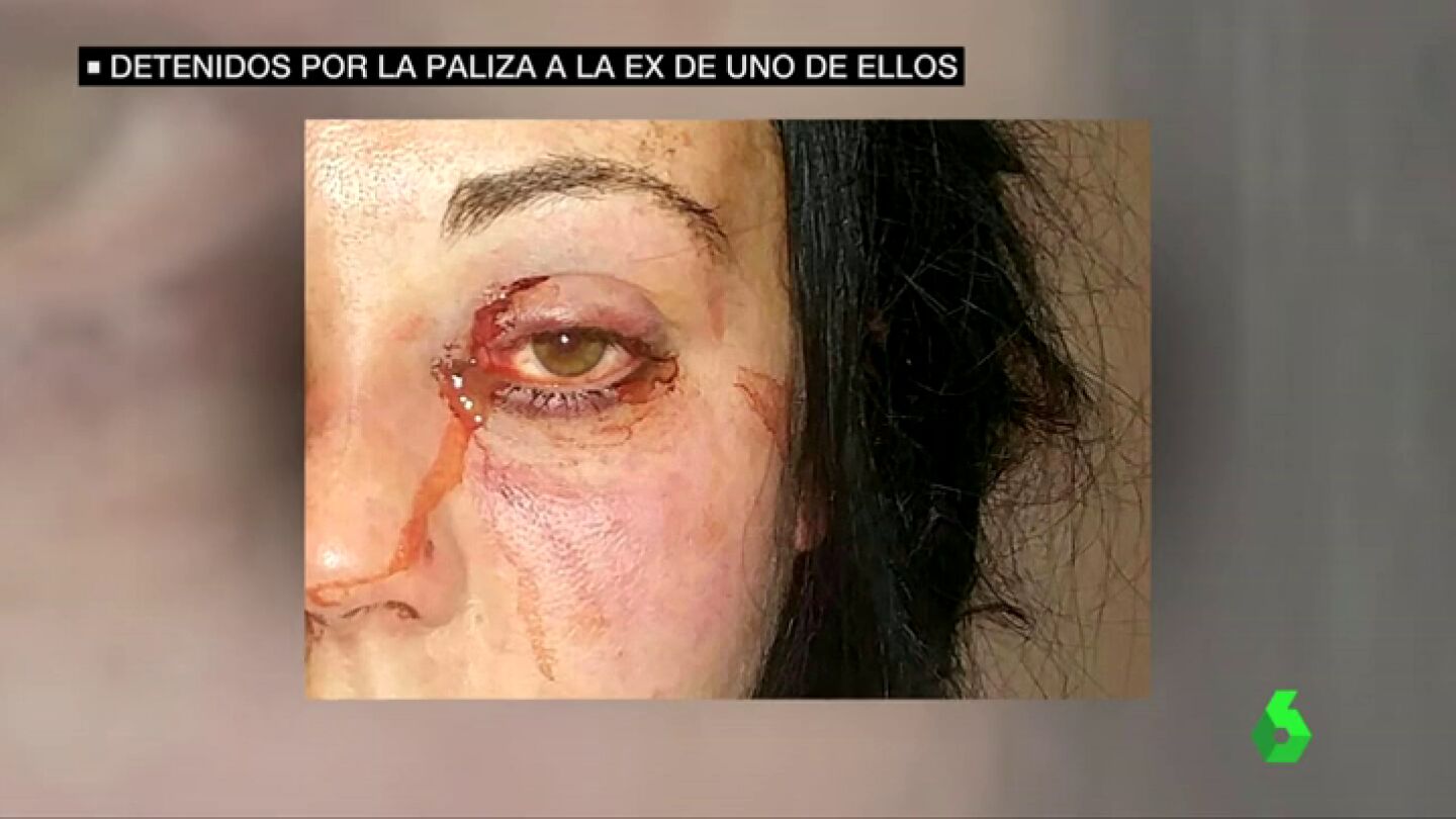 Consigue la detenci&oacute;n del exnovio de su hija tras una brutal agresi&oacute;n machista: "Estos hijos de puta le han pegado una paliza de muerte"