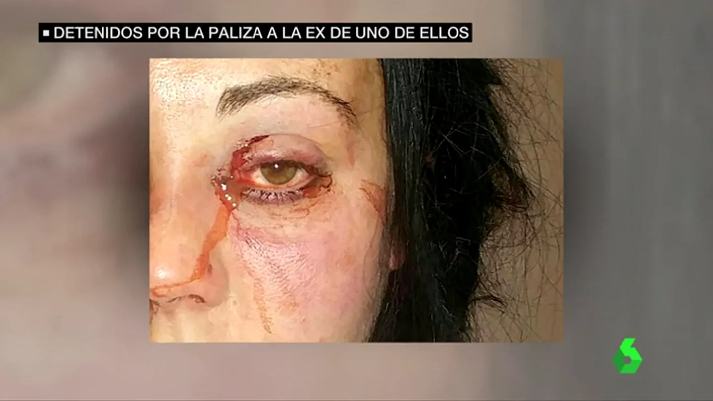 Consigue la detención del exnovio de su hija tras una brutal agresión machista: "Estos hijos de puta le han pegado una paliza de muerte" Consigue la detención del exnovio de su hija tras una brutal agresión machista: "Estos hijos de puta le han pegado una paliza de muerte"